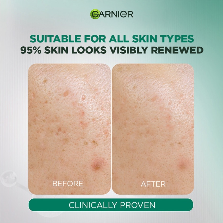 Tri Acid Serum 20ml