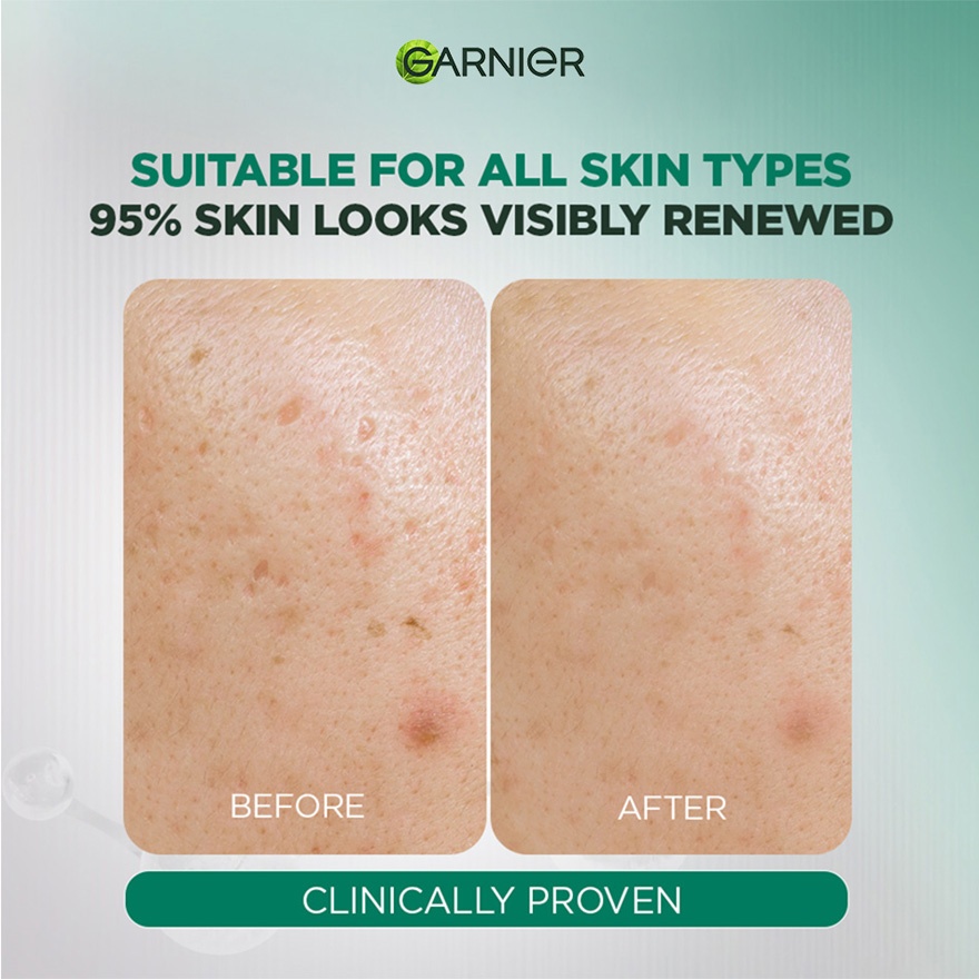 Tri Acid Serum 20ml