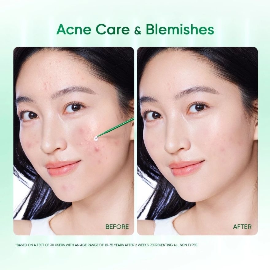 Acne Drying Lotion 10ml