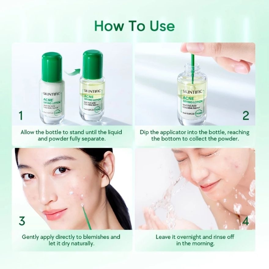Acne Drying Lotion 10ml