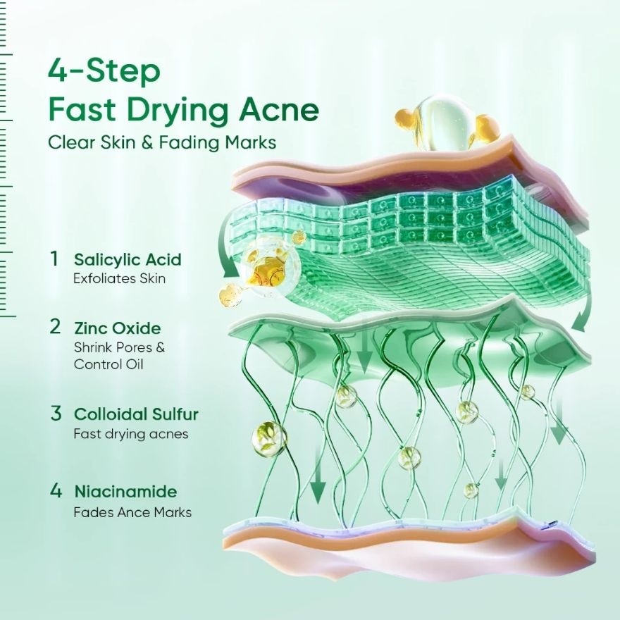 Acne Drying Lotion 10ml