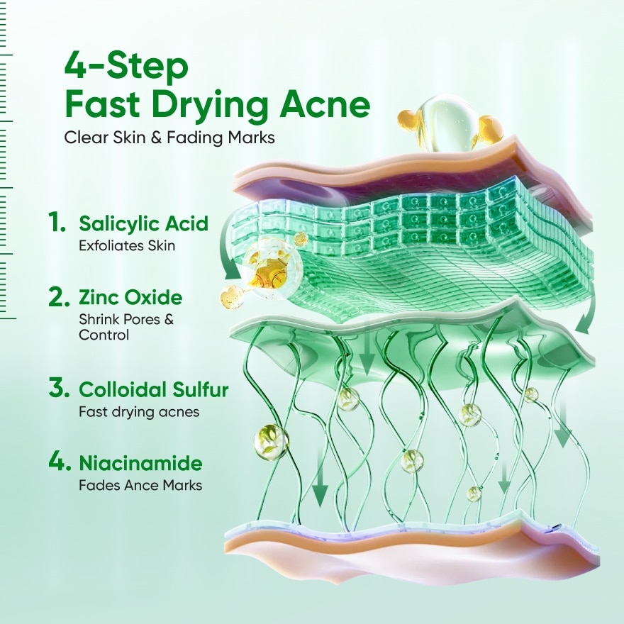 Acne Drying Lotion 10ml