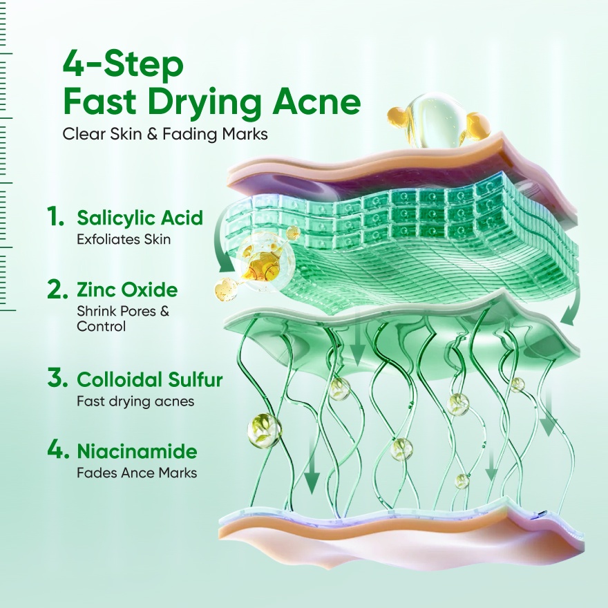 Acne Drying Lotion 10ml image