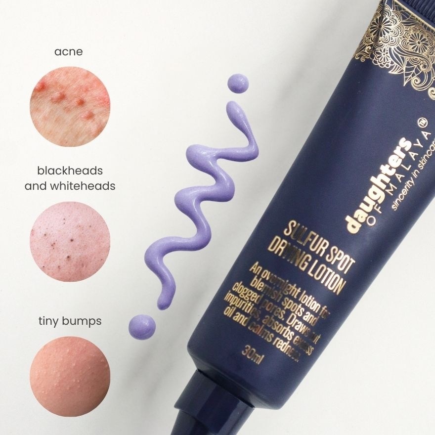 Sulfur Spot Drying Lotion 30ml
