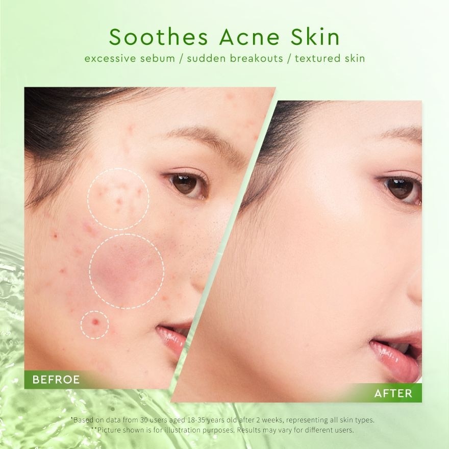 Mugwort Acne Gel Mask 50g