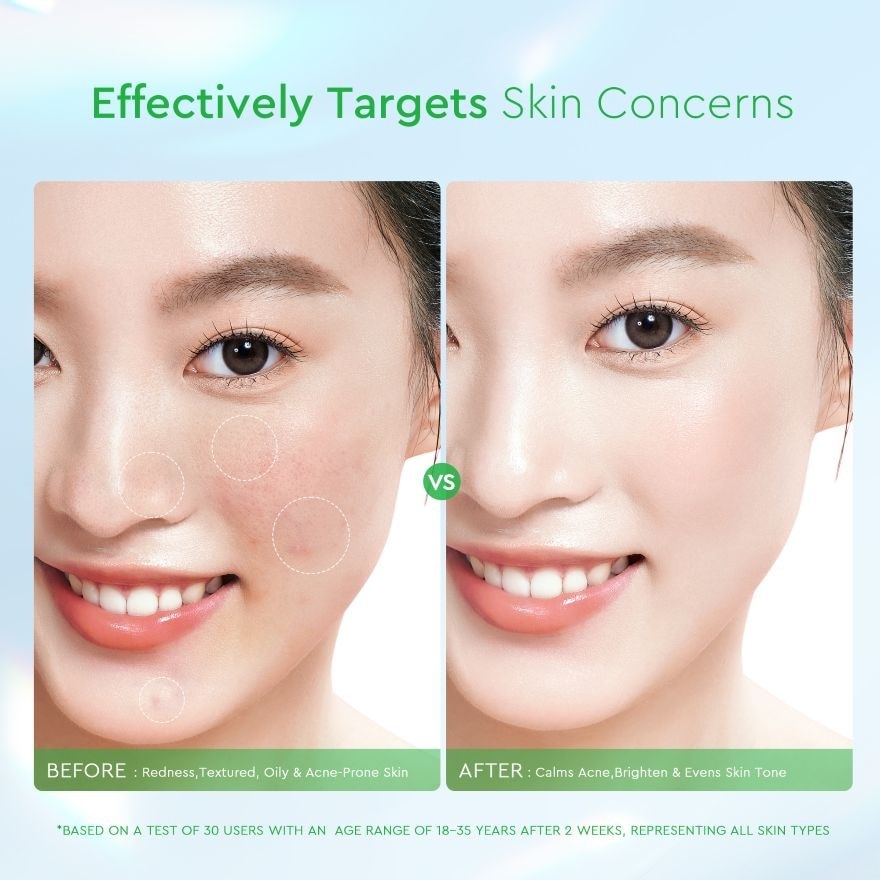 Centella Salicylic Acid Exfoliating Acne Pads 30s