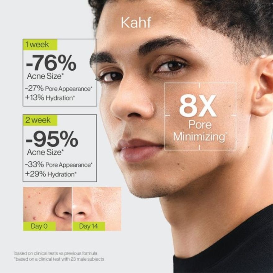 Acne and Pore Cleanse Scrub Face Wash 100 ml