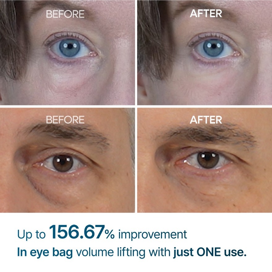 Eyephalt Eyebag Cream 10ml image