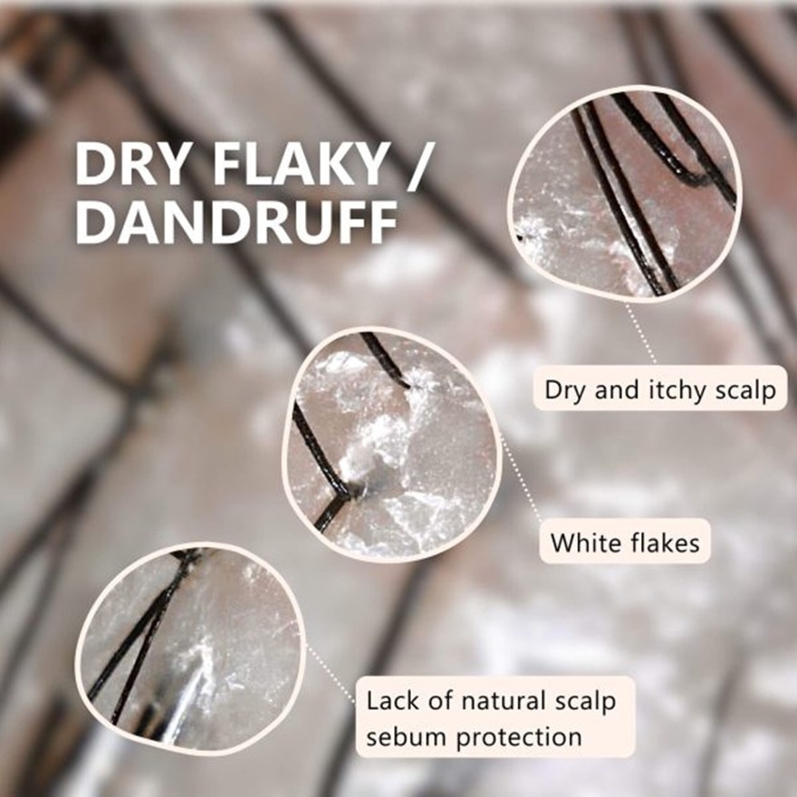 Dry Scalp Soothing Shampoo 400ml