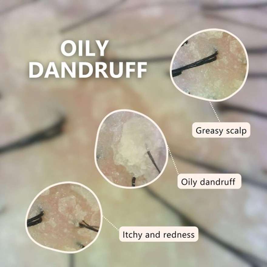 Oily Scalp Balancing Shampoo 400ml