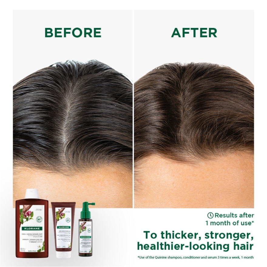 Quinine & Edelweiss Starter Kit 1's