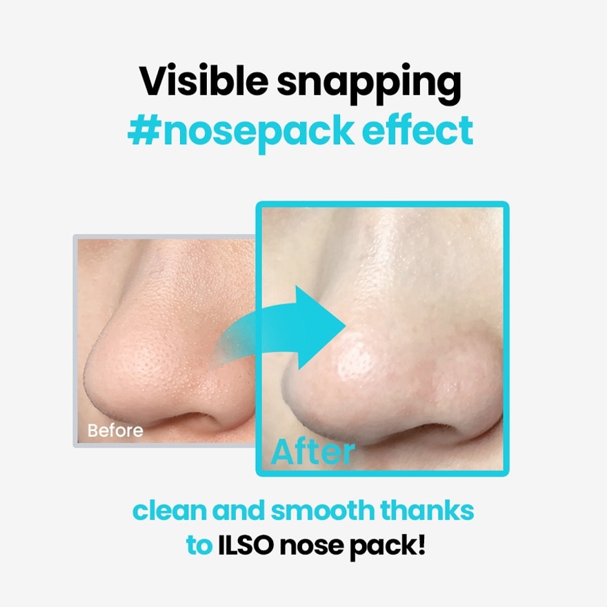 Natural Mild Clear Nose Patch 2-Step 5s