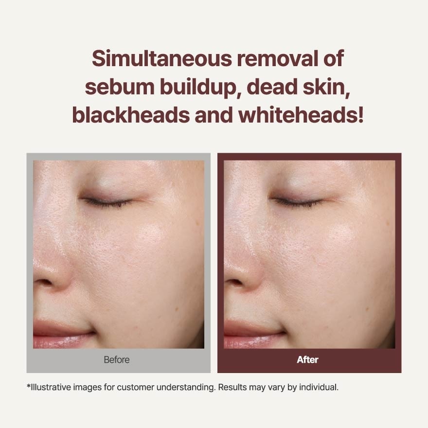 Volcanic BHA Pore Cleansing Foam 150g