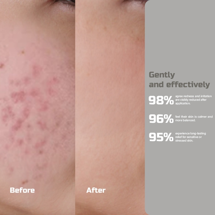 10x Soothing Complex Hyper Relief Serum 30ml