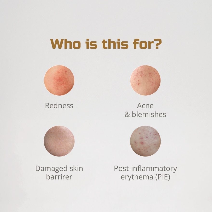 10x Soothing Complex Hyper Relief Serum 30ml