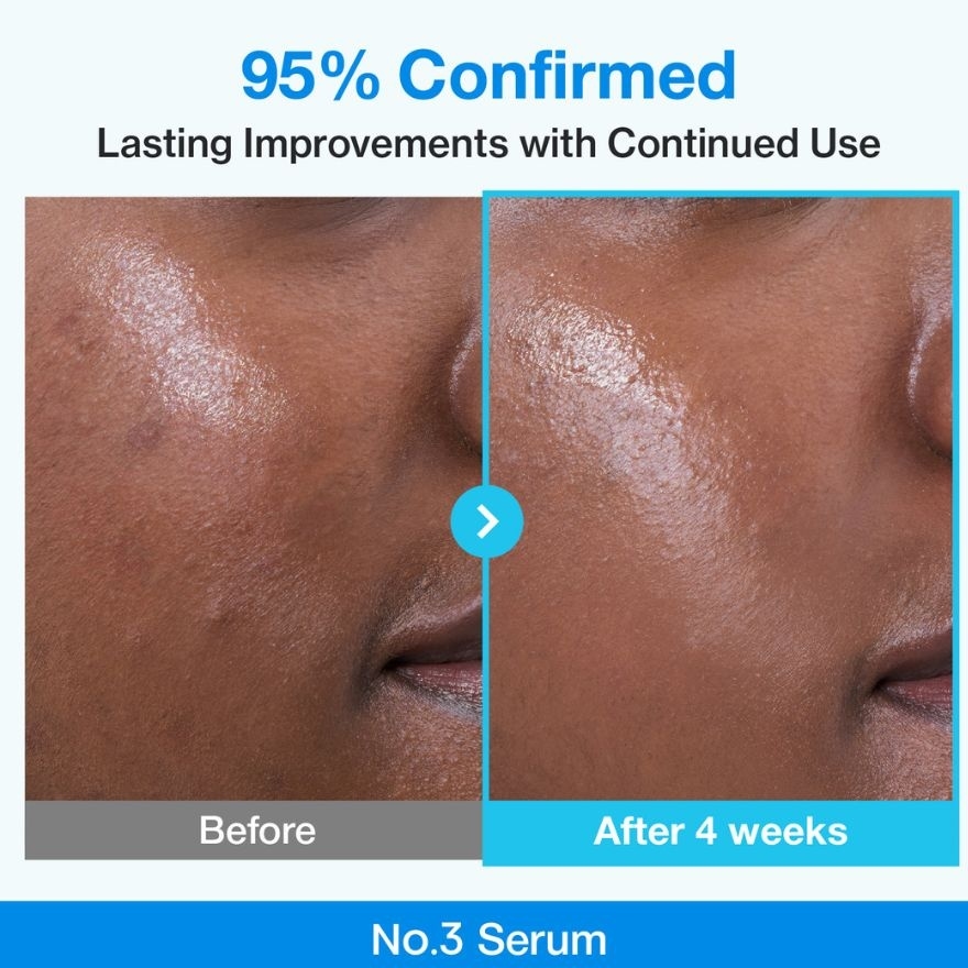 No.3 Blue Bio-Retinol Pore Refining Serum 30ml image