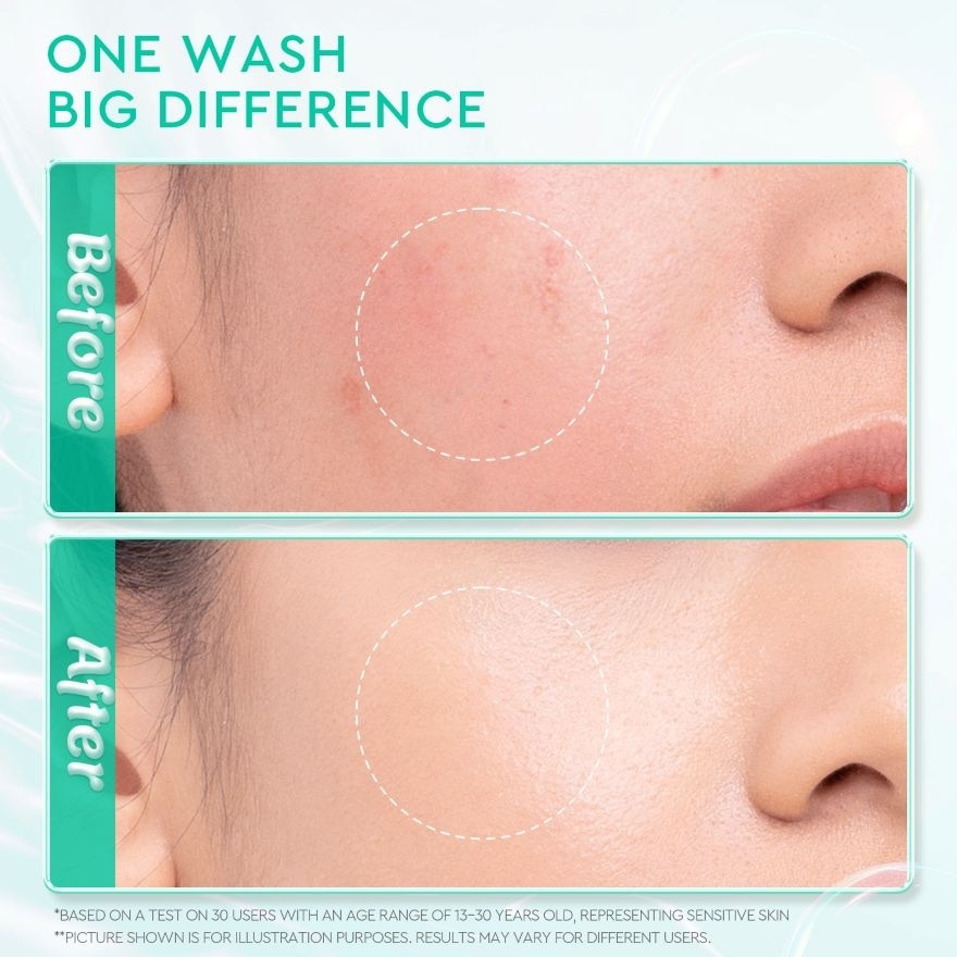 Low pH 5.5 Gentle Facial Wash 70ml