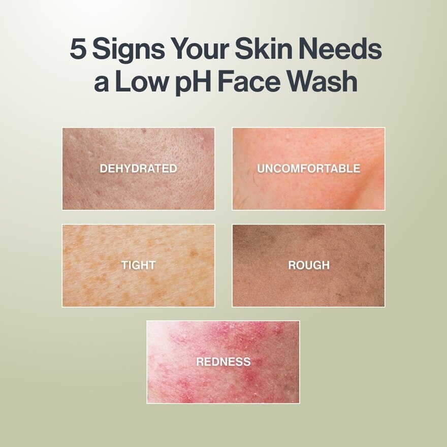 Acne Care AminoGel Face Wash 100ml