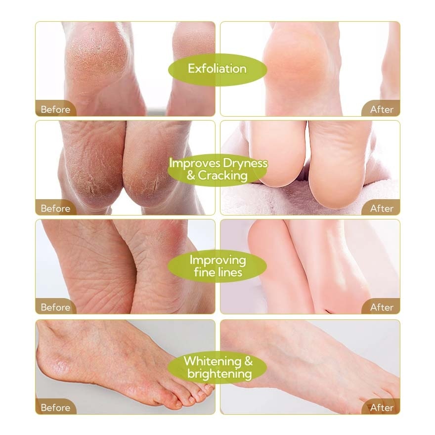 Aloe Vera Foot Peel Mask 40g