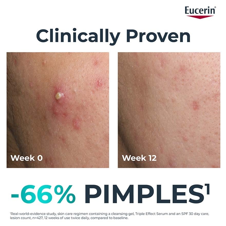 Dermopure Clinical Triple Action 40ml