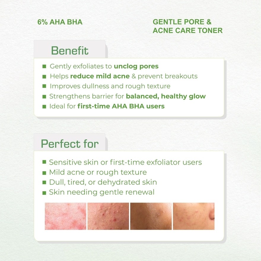6% AHA BHA Gentle Pore & Acne Care Toner 80ml