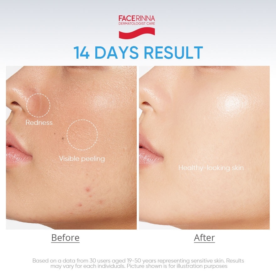 Ceramide B5 Balancing Moisturizer 30g