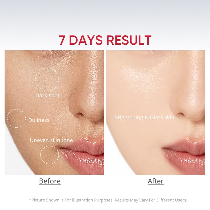 5% Niacinamide 1% TXA Bright Dark Spot Moisturizer 30g