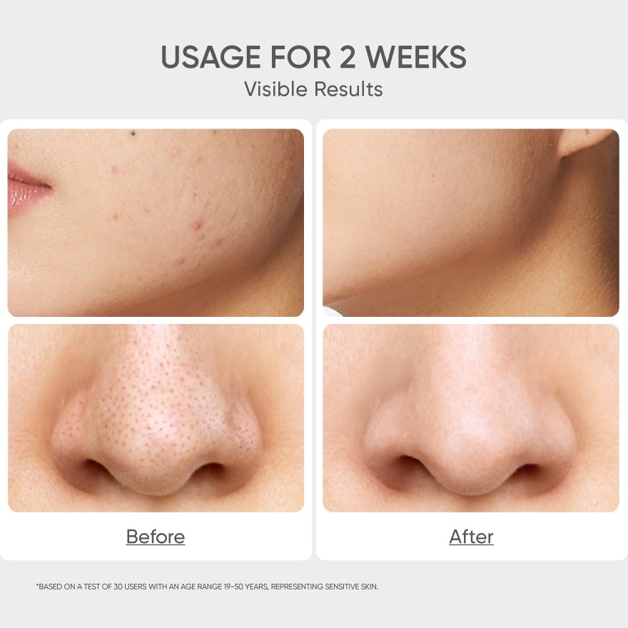 Salicylic Acid Acne Toner 100ml