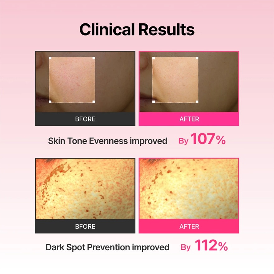 Arbutin Skin Booster Serum 150ml & Device Set