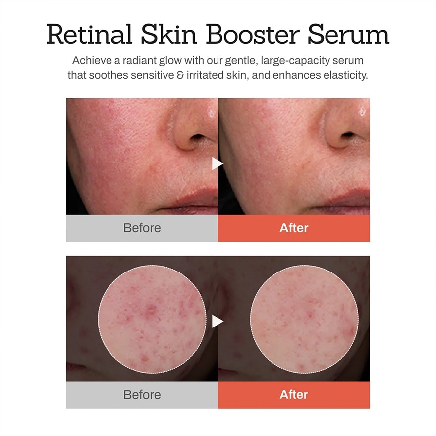 Retinal Skin Booster Serum 150ml