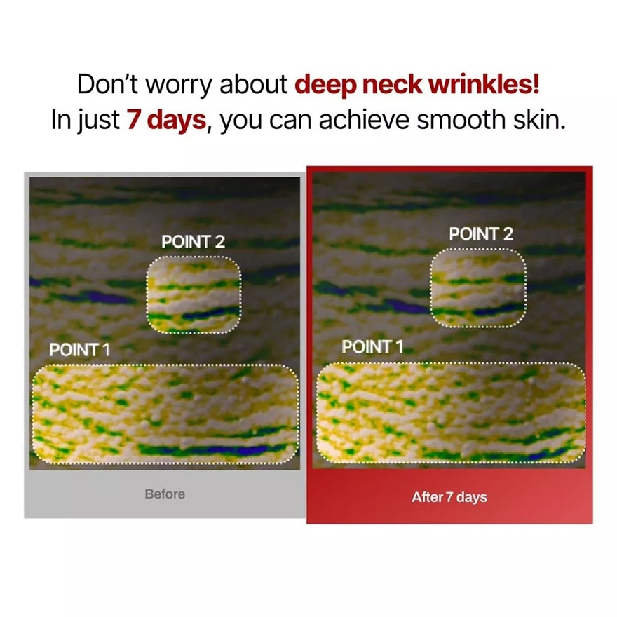 Wrinkle-Fit Neck Mask 7s
