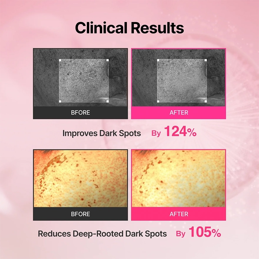 Tranexamic Acid Booster Cream 100ml & Device Set