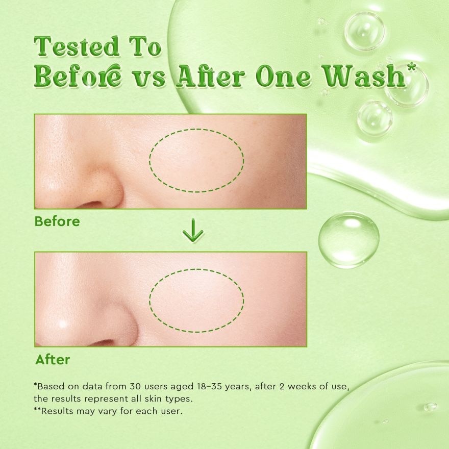 Glycolic Oil Control Facial Wash 70ml