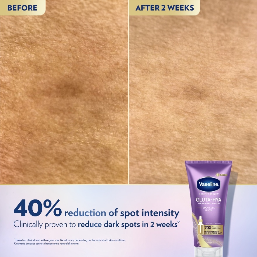 Gluta-Hya Serum Burst Lotion Spotless Glow 170ml