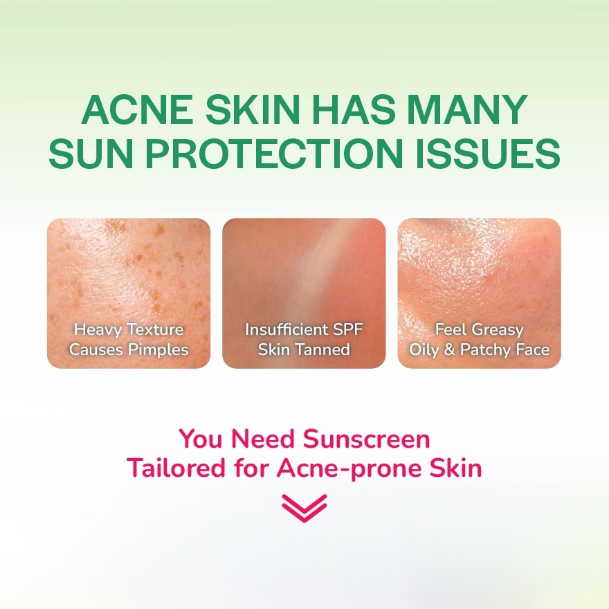 Anti-Acne Oil Control Sunscreen 30g
