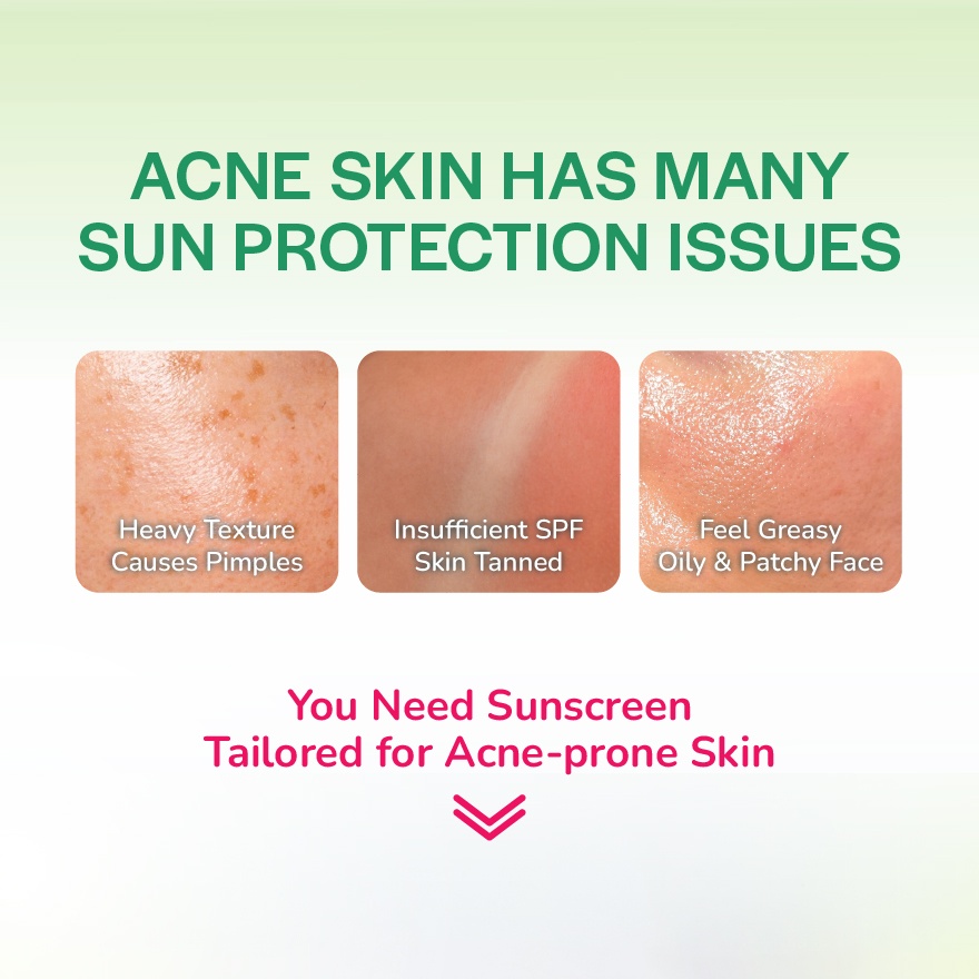Anti-Acne Oil Control Sunscreen 30g image