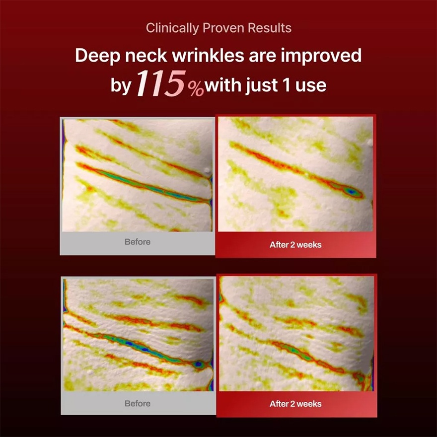 Wrinkle-Fit Neck Mask 1s image