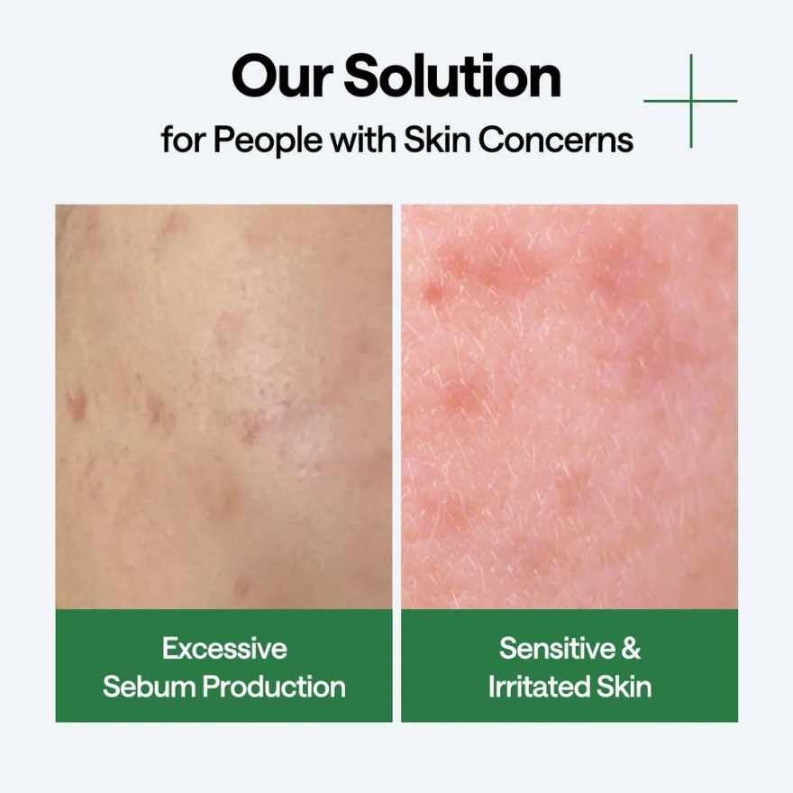 Teatree Wrapping Serum Mask 1s image