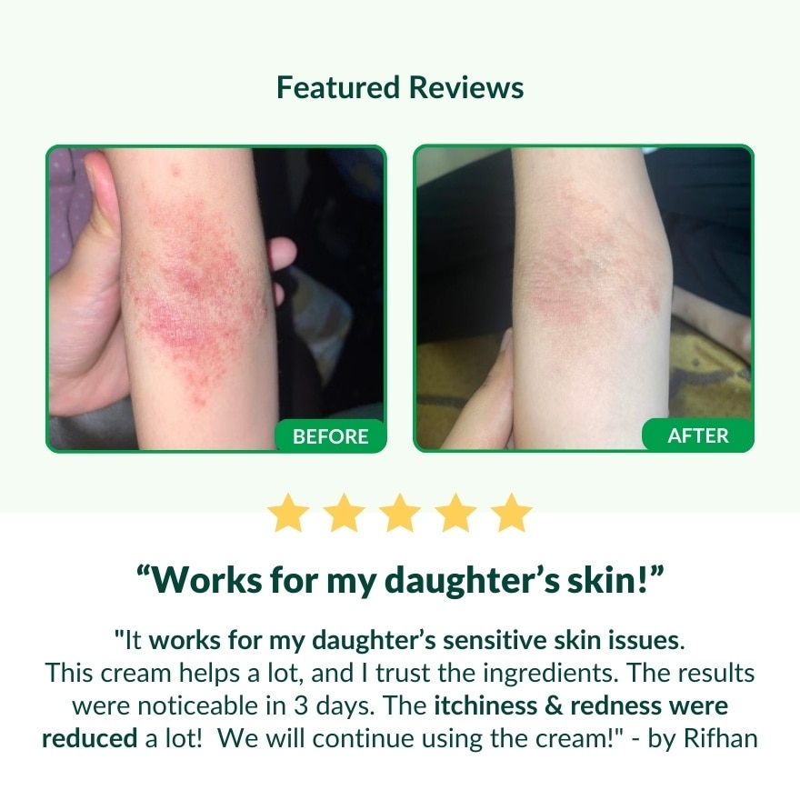 Herbal Skin Repair Cream 15G