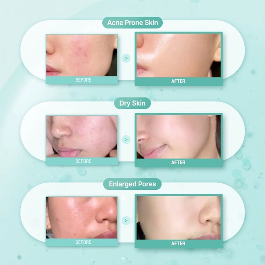 PDRN Spirulina Soothing Repair Serum 50ml