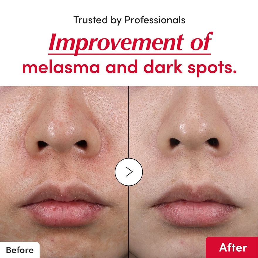 [PEANUTS] Vitamin Illuminating Serum 30ml