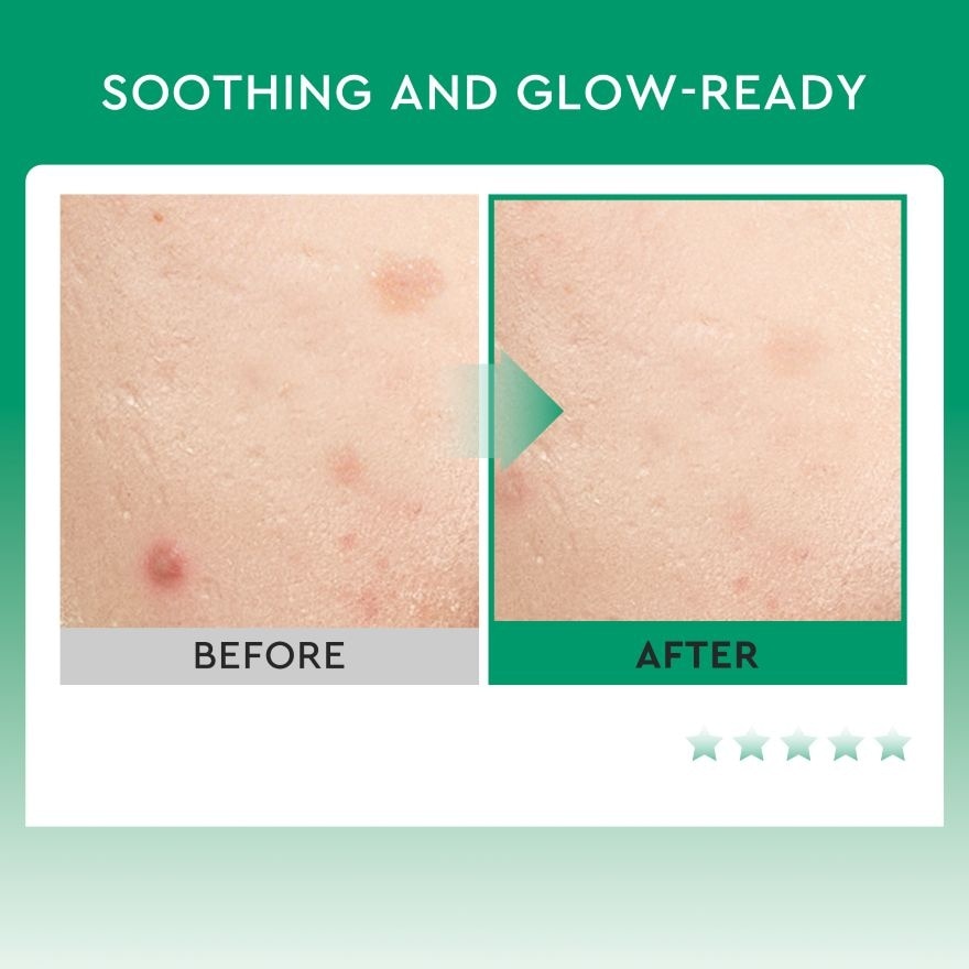 7% Glycolic Acid Toner 100ml