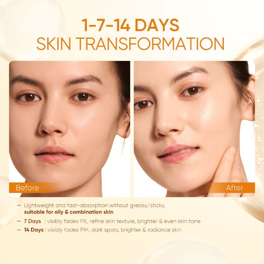 Vitamin C Brightening Boost Moisturizer 30g