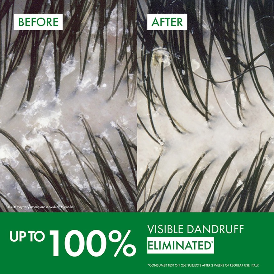 Anti-Dandruff Hair Shampoo 200ml (Dry hair)
