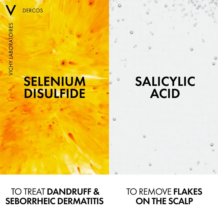 Anti-Dandruff Hair Shampoo 200ml (Normal to Oily hair)