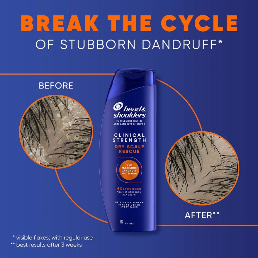 Clinical Strength Dry Scalp Rescue Shampoo 400ml