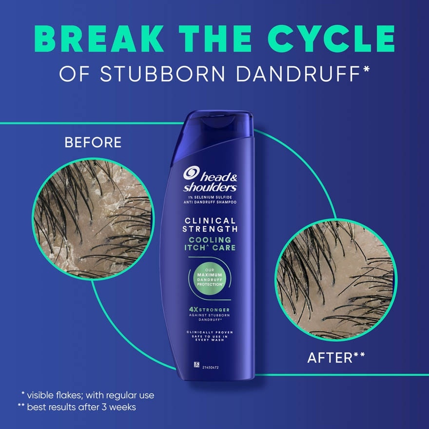 Clinical Strength Cooling Itch Control Shampoo 400ml