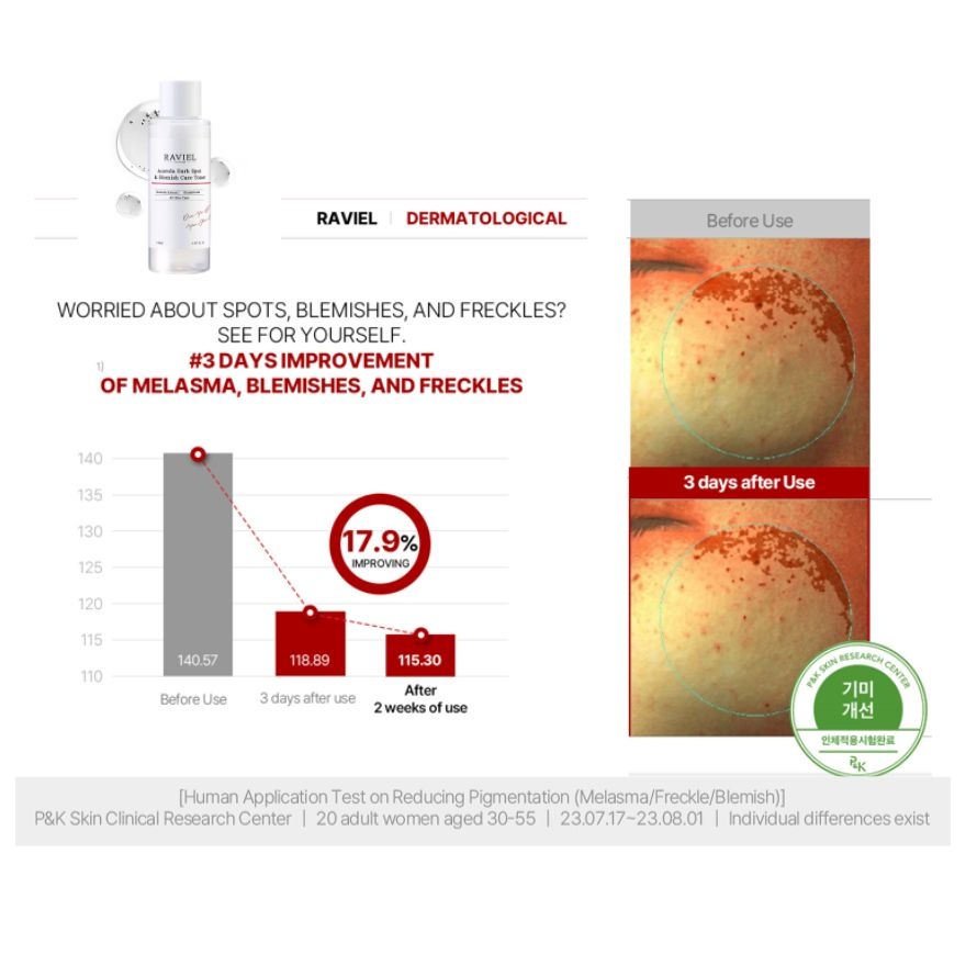 Acerola Dark Spot & Blemish Care Toner  150ml