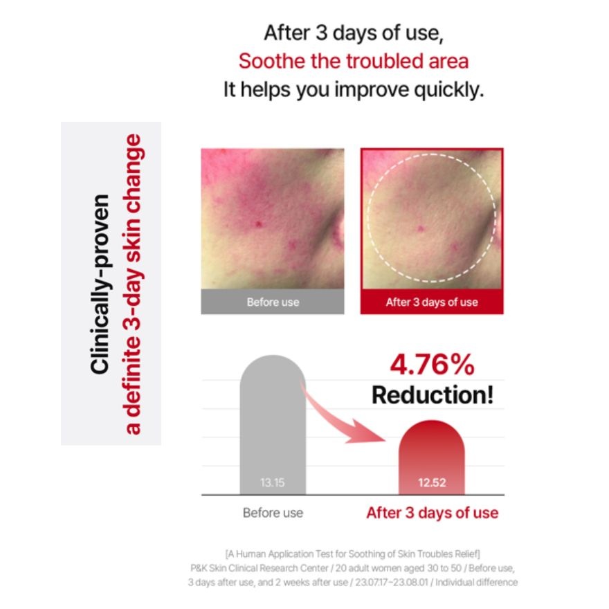 Acerola Dark Spot & Blemish Care Cream 50ml