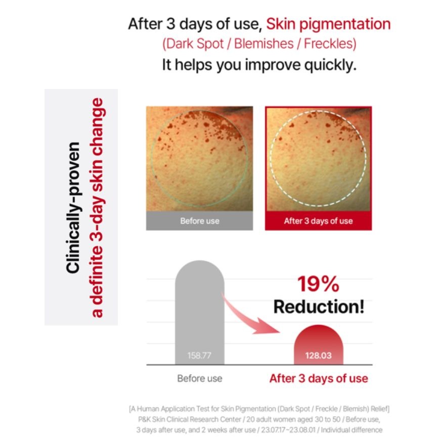 Acerola Dark Spot & Blemish Care Cream 50ml